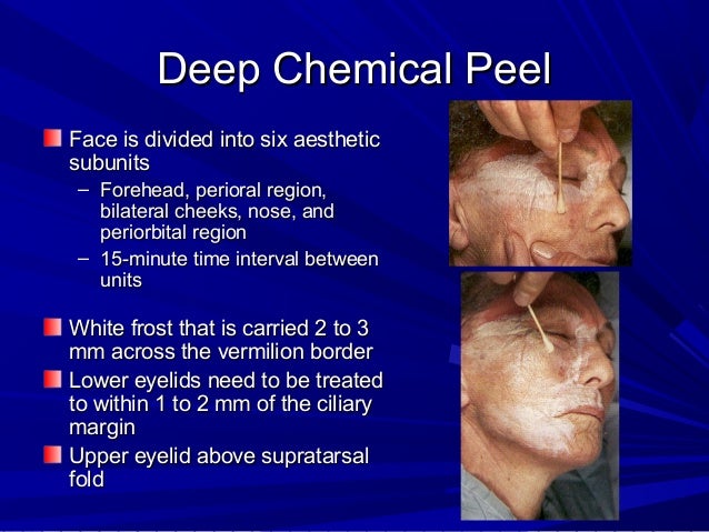 Torrent tiffany taylor anal Deep facial peels
